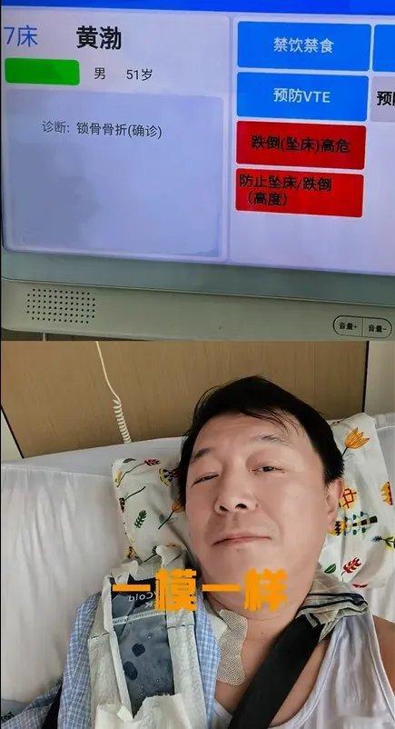 “疯狂的赛车”9月3日演员黄渤分享了自己在家门口骑自行车摔伤的经历，医院诊断报告