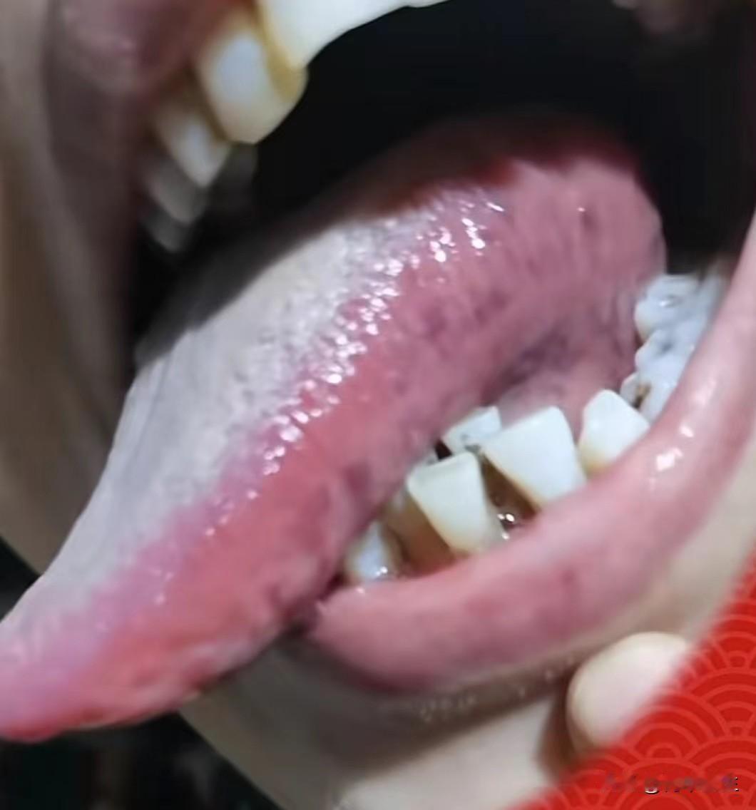 血不通，汗不止，爱出汗的朋友要当心了，这个症状在提示你身体有血瘀
今天有这样一个