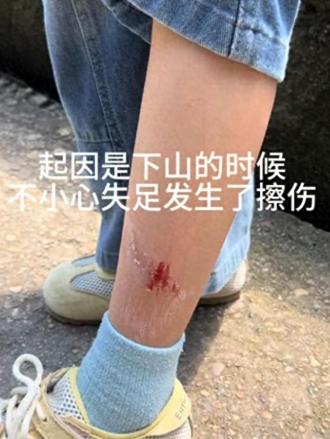 五一假期游江西龟峰，女子女儿小腿刮伤。景区大叔好心帮忙擦药包扎，没成想女子转头就