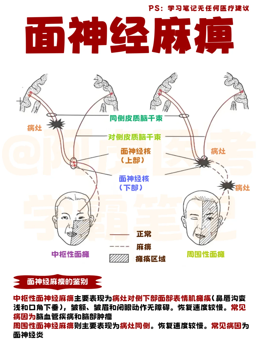 阿虎医考笔记📒：中枢性和周围性面瘫👆