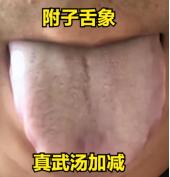 附子和肉桂，都是补阳热药，但方向不同：阴寒用附子，虚寒用肉桂！
 
 
1、阴寒