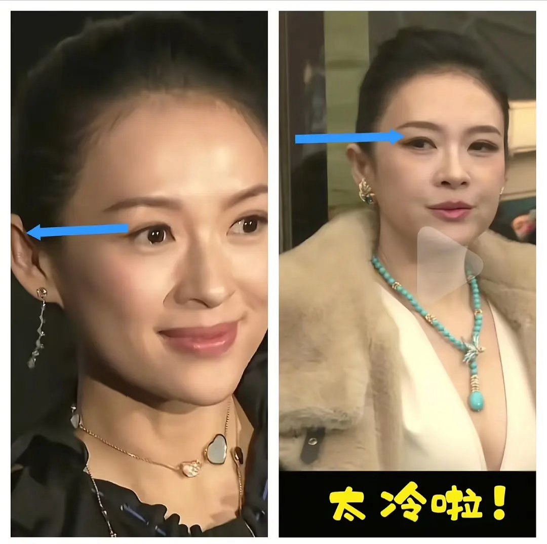 章子怡这变老也太明显了，眼角都下垂了 