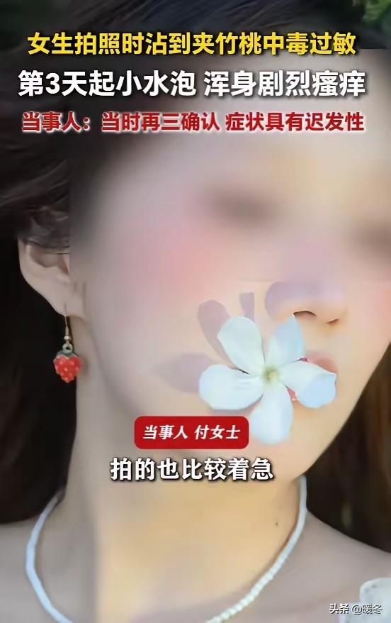 嘴含夹竹桃拍照！福建女子几分钟毁容，浑身水泡流脓，剧毒就藏在身边！
 
就为了拍