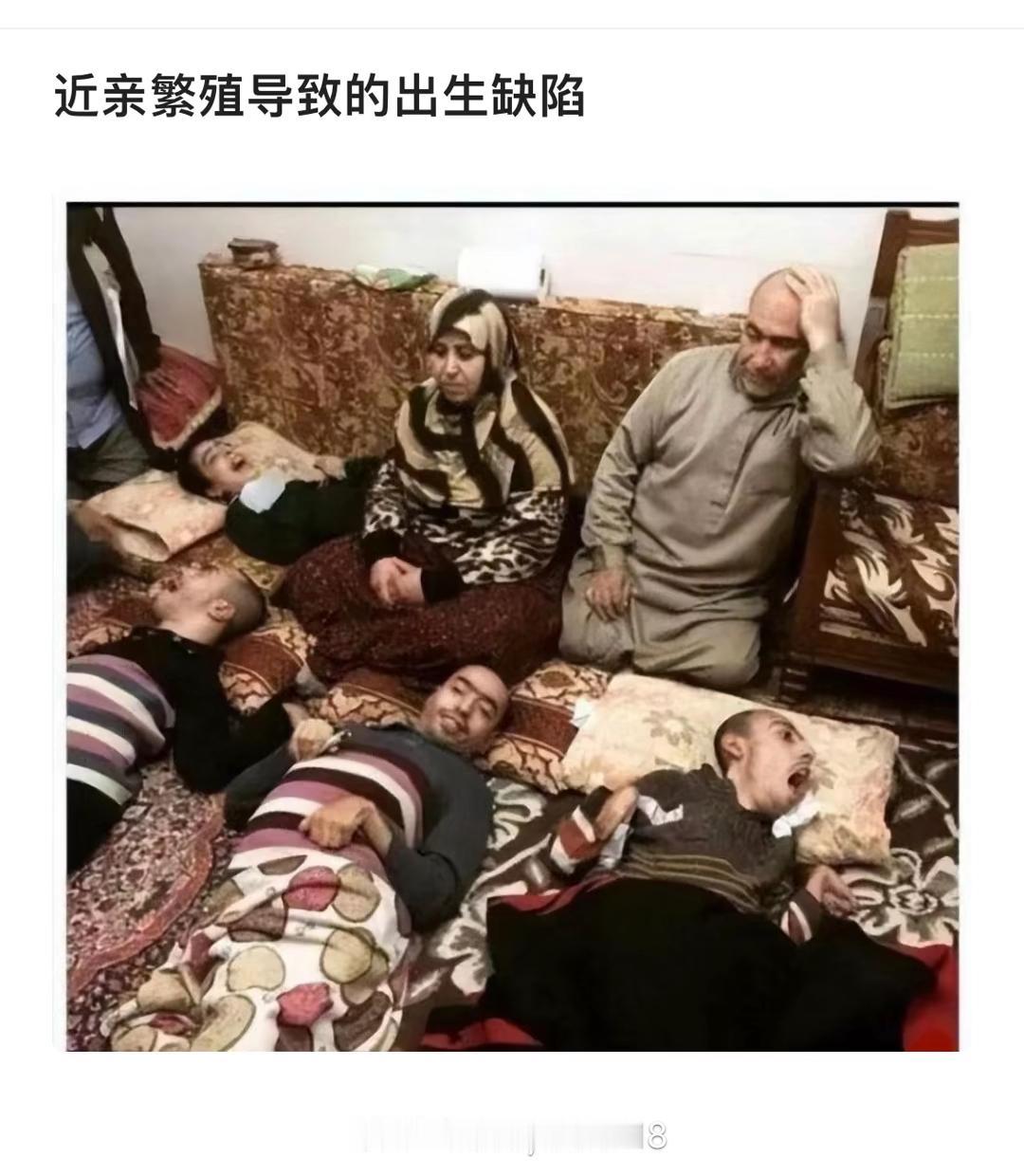 近亲繁殖的恶果真的太可怕了。它指遗传关系近的个体间繁殖，在人和动物中危害极大。