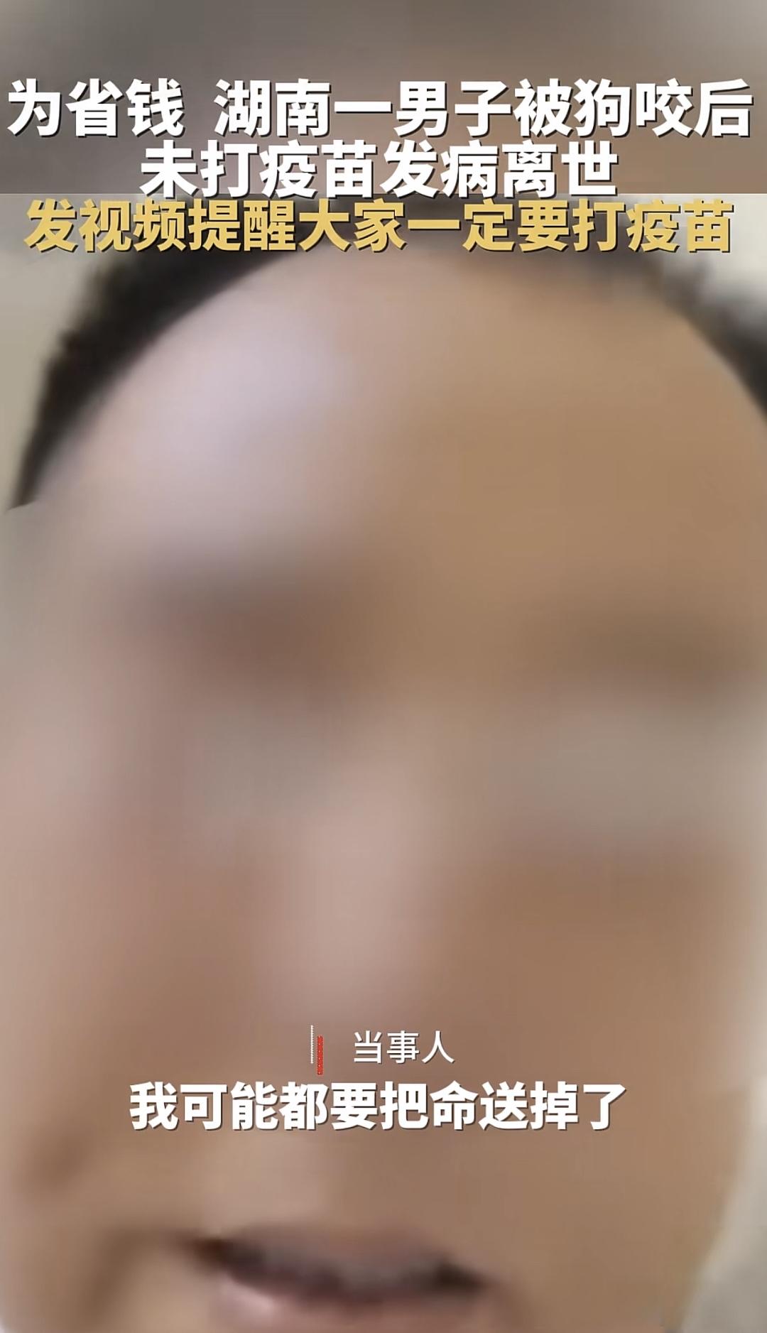 看到这个，我忍不住庆幸的起来，原来当时我是真的命大。
湖南这名男子就是被狗咬之后