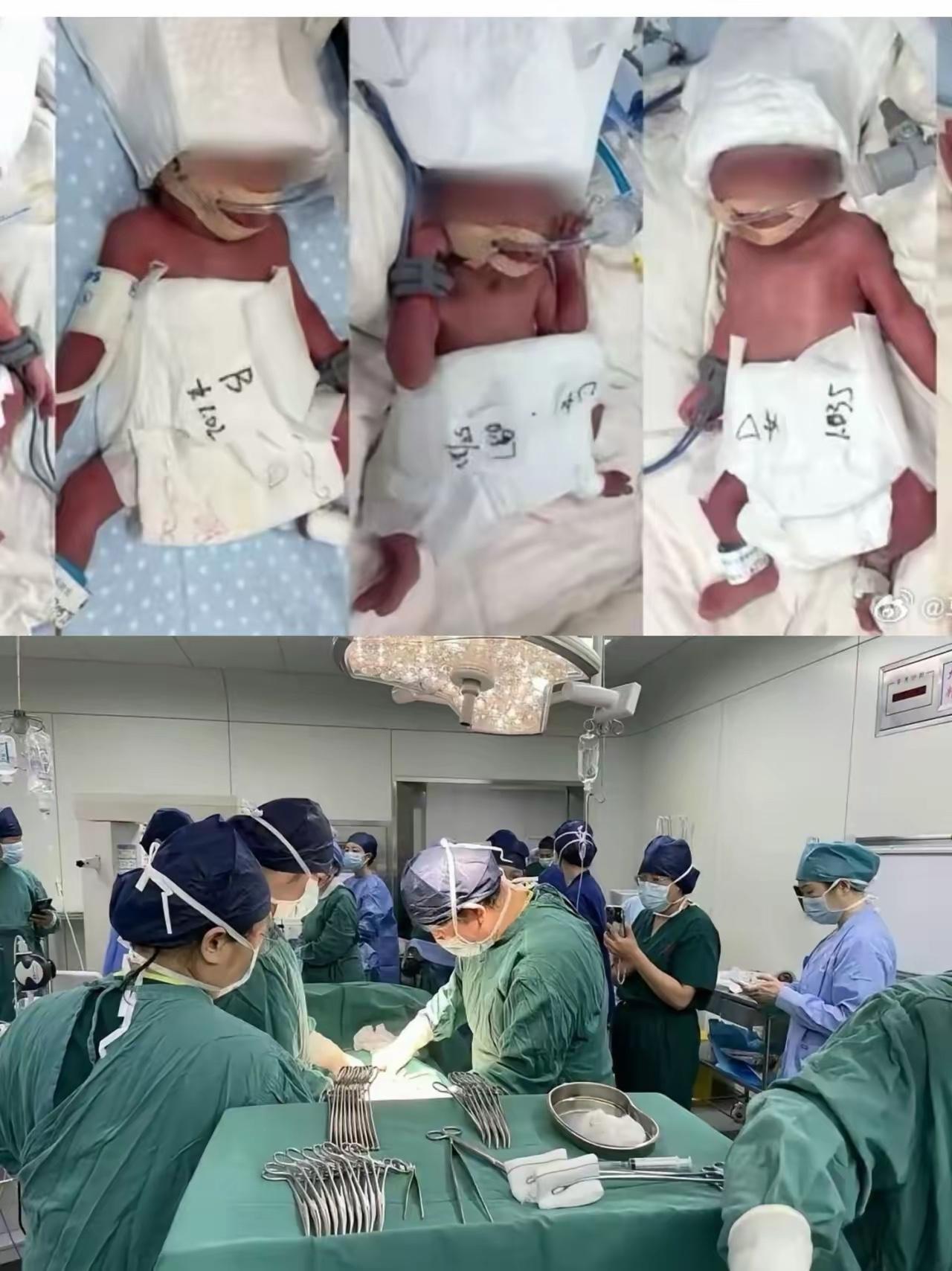 终于弄明白5胞胎妈妈为什么要跨越几千公里到武汉医院，找李家福医生接生了。2026