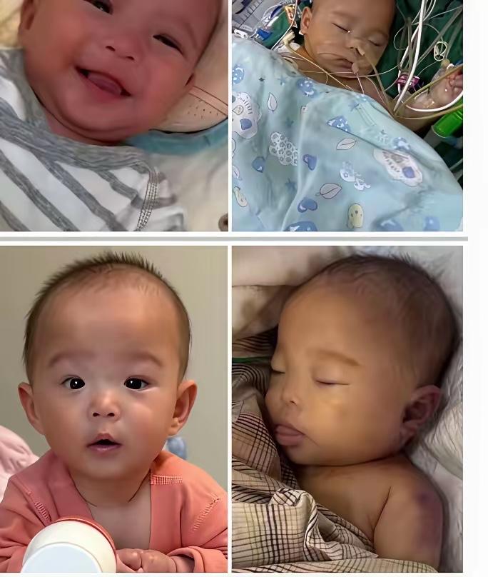 小洛熙，才五个月的小宝贝，因为“心房膈肌圆孔”医生建议手术，本来两个小时左右的手