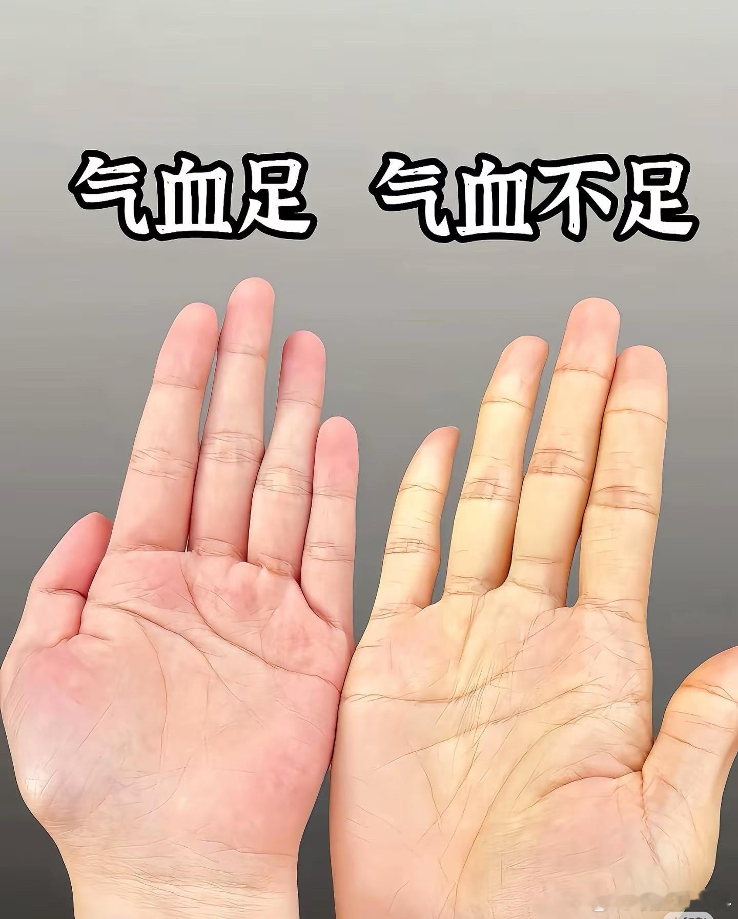 你以为的气血足和实际上的气血足 总觉得脸白有光泽就是气血旺，现实里不疲惫乏力、不