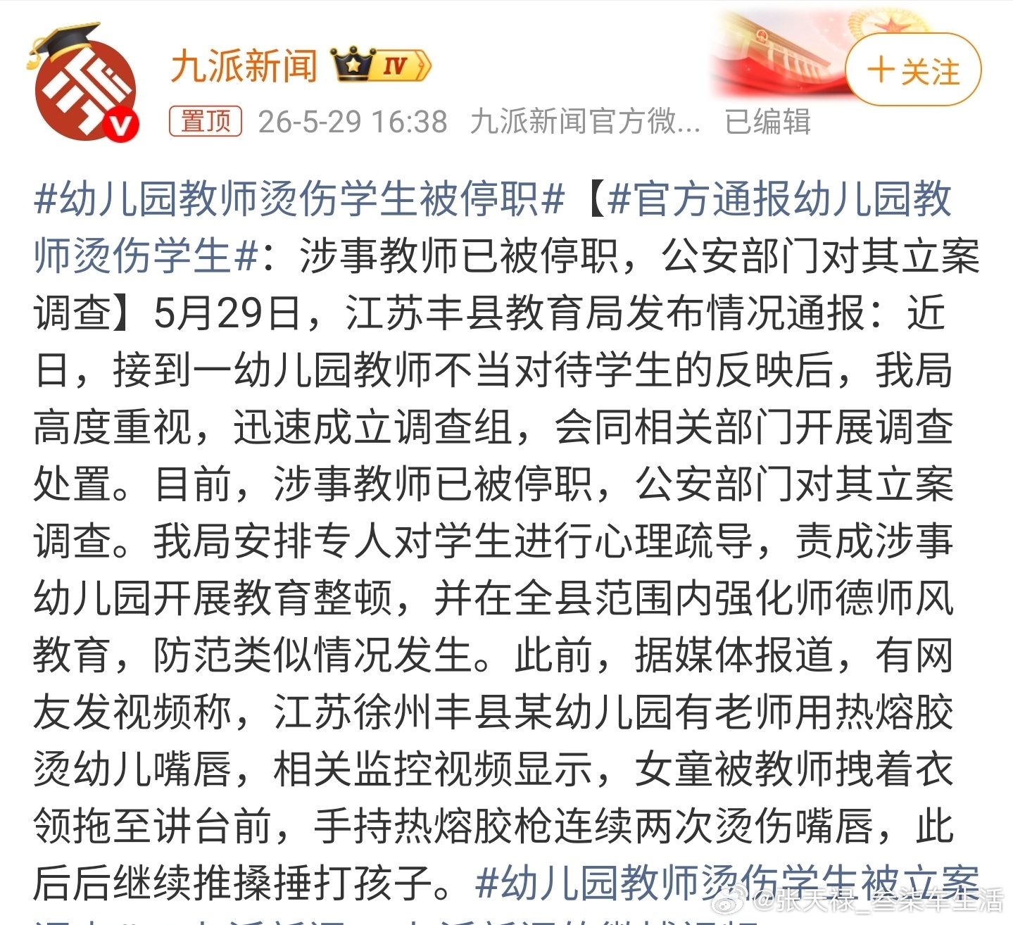 幼儿园教师烫伤学生被停职TMD的这种老师，应该判个一年半载，家长看了得多痛心啊
