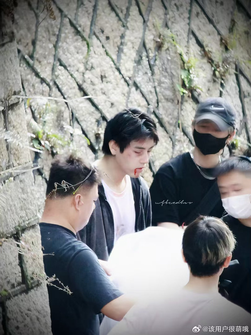 陈飞宇殴打妆不像化的 真的不像化的！陈飞宇这殴打妆太有冲击力了，好让人入戏，阿瑟