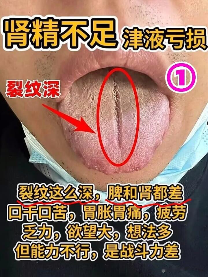挑战半个月看999个舌象，第一天[碰拳][碰拳][碰拳]
你发我看，结果马上出！