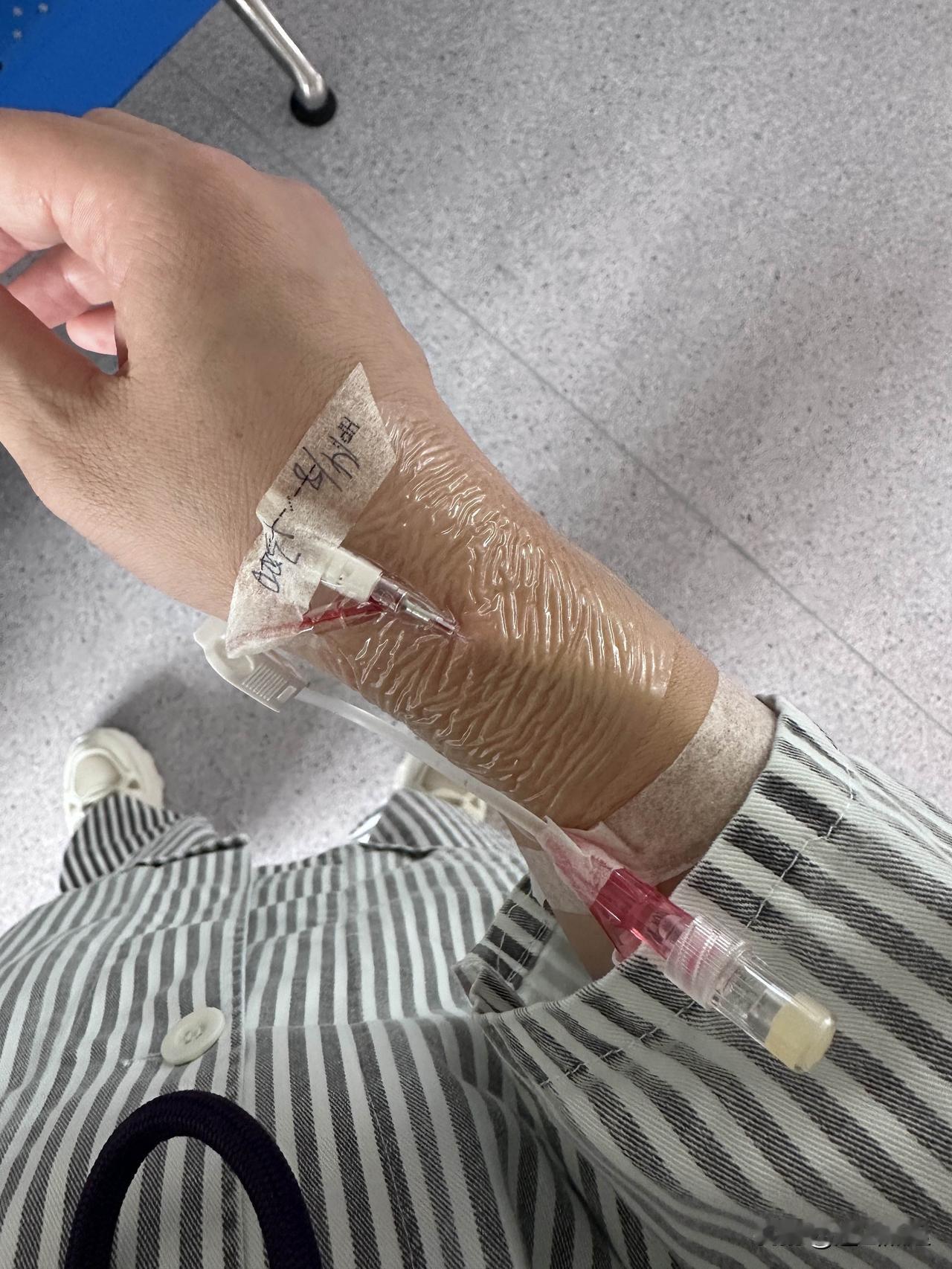 这针头留的很可怕[流泪]，没事，很小的问题，已经解决了。今天七点半起来了，英德下