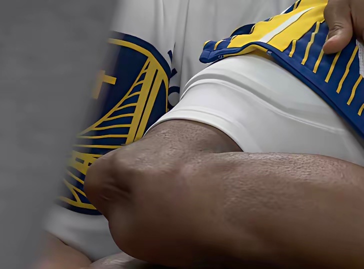 NBA本赛季最可怕伤病出现，勇士球员穆迪左腿膝盖整个凹陷令人不寒而栗。CBA刚刚