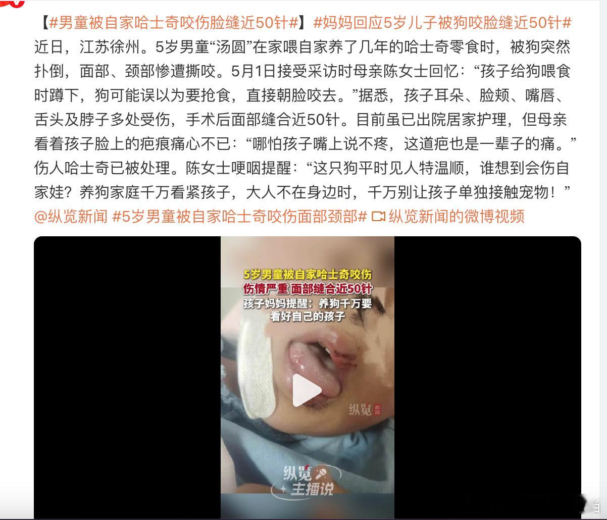 狗子救主类似摆拍编造，永远抵不过实实在在、真真切切被狗伤的伤口。 