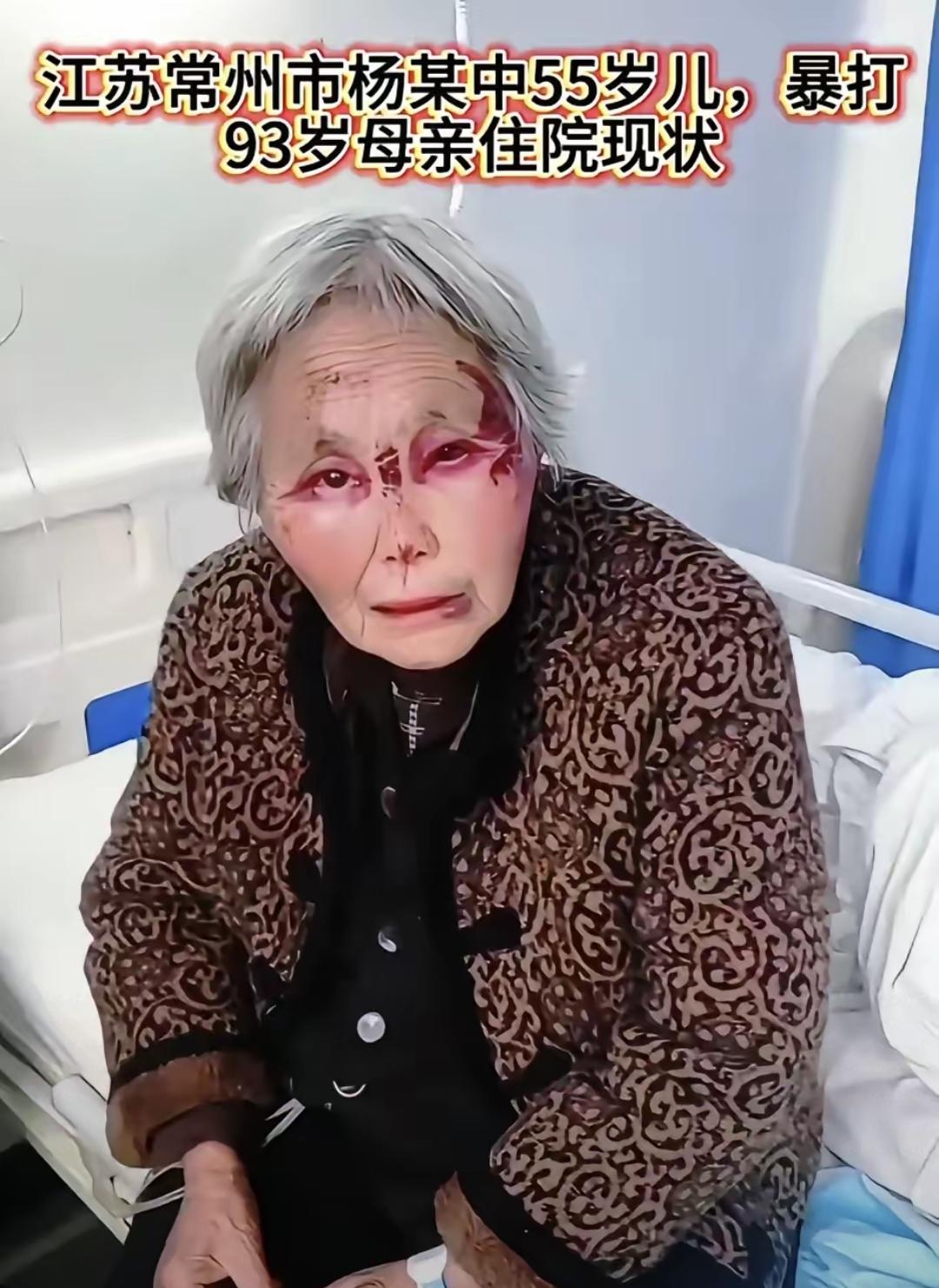 四个闺女一个儿子，本是人人羡慕的“儿女双全”，常州这位老人却被亲儿子打得满脸淤青