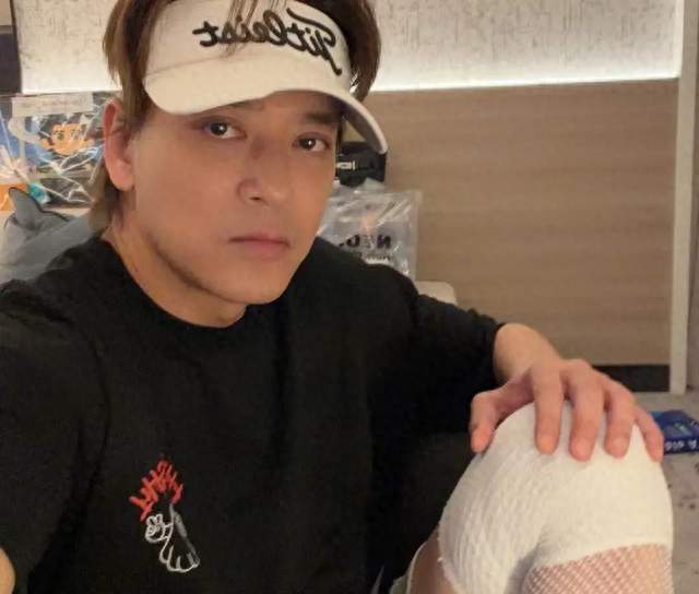 香港男星面部僵硬被指医美过度，曾与圈外女友订婚，婚事最终告吹