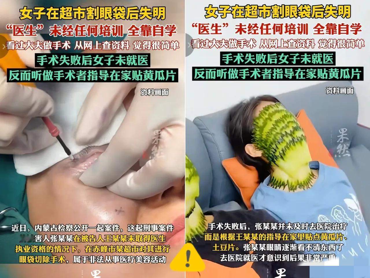 谁能想到
超市除了卖生鲜零食，
还藏着“祛眼袋手术室”？

内蒙古这起离谱事，把