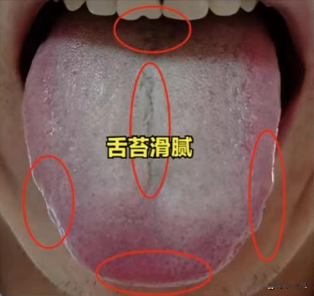 明明是肾虚，地黄丸却没效果？还一补就上火，醒醒吧，你的脾胃也不好

主诉：欲望强