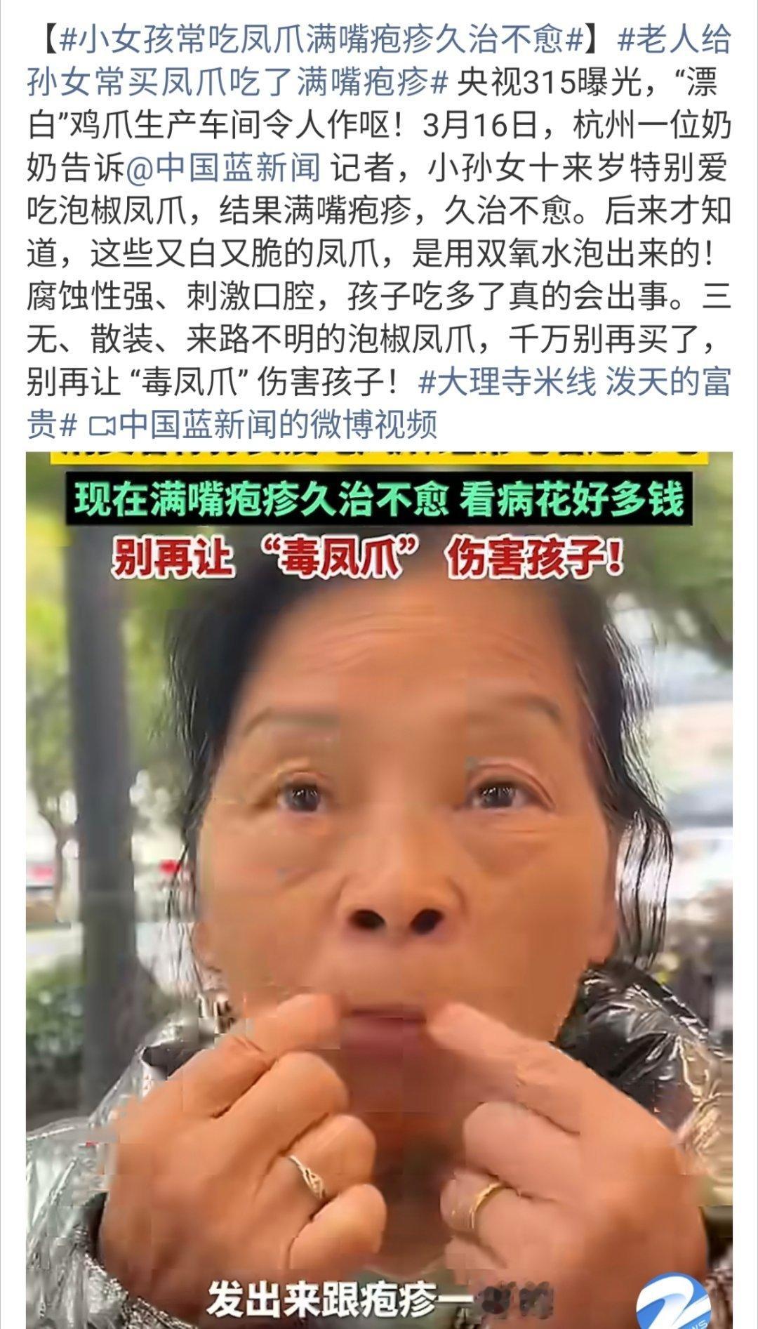 小女孩常吃凤爪满嘴疱疹久治不愈这是真吓人啊怪不得现在乱七八糟的病都越来越年轻化吃
