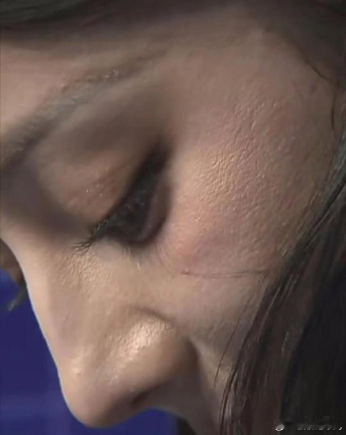 由于长时间带妆和镁光灯照射，许多女明星的皮肤状况堪忧。 ​​​