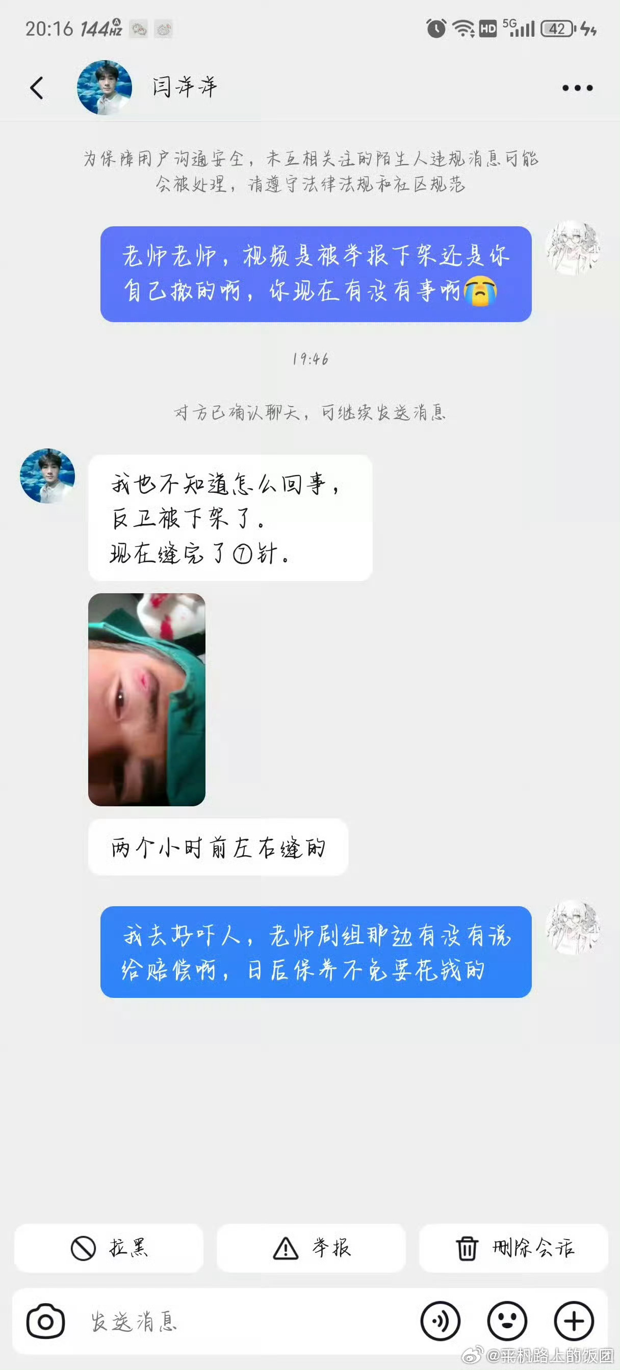 有网友去问了《归良辰》剧组那个受伤的群演，视频怎么没有了，群演说不知道因为什么原