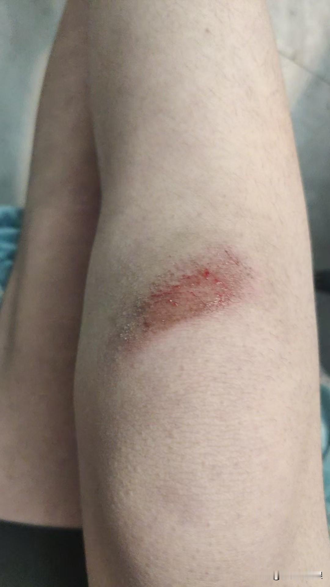 中考体考800米摔了一跤，怎么办？
     很多人都说中考体育长跑要是摔了一跤