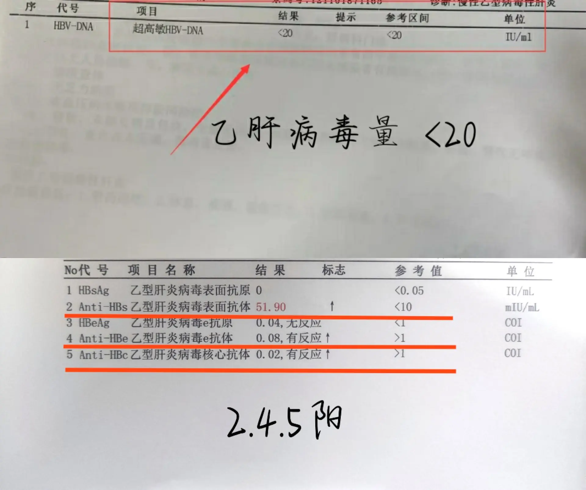 乙肝病毒小于20就绝对安全了吗？病毒检测低于20，在医学定位是相对安全...