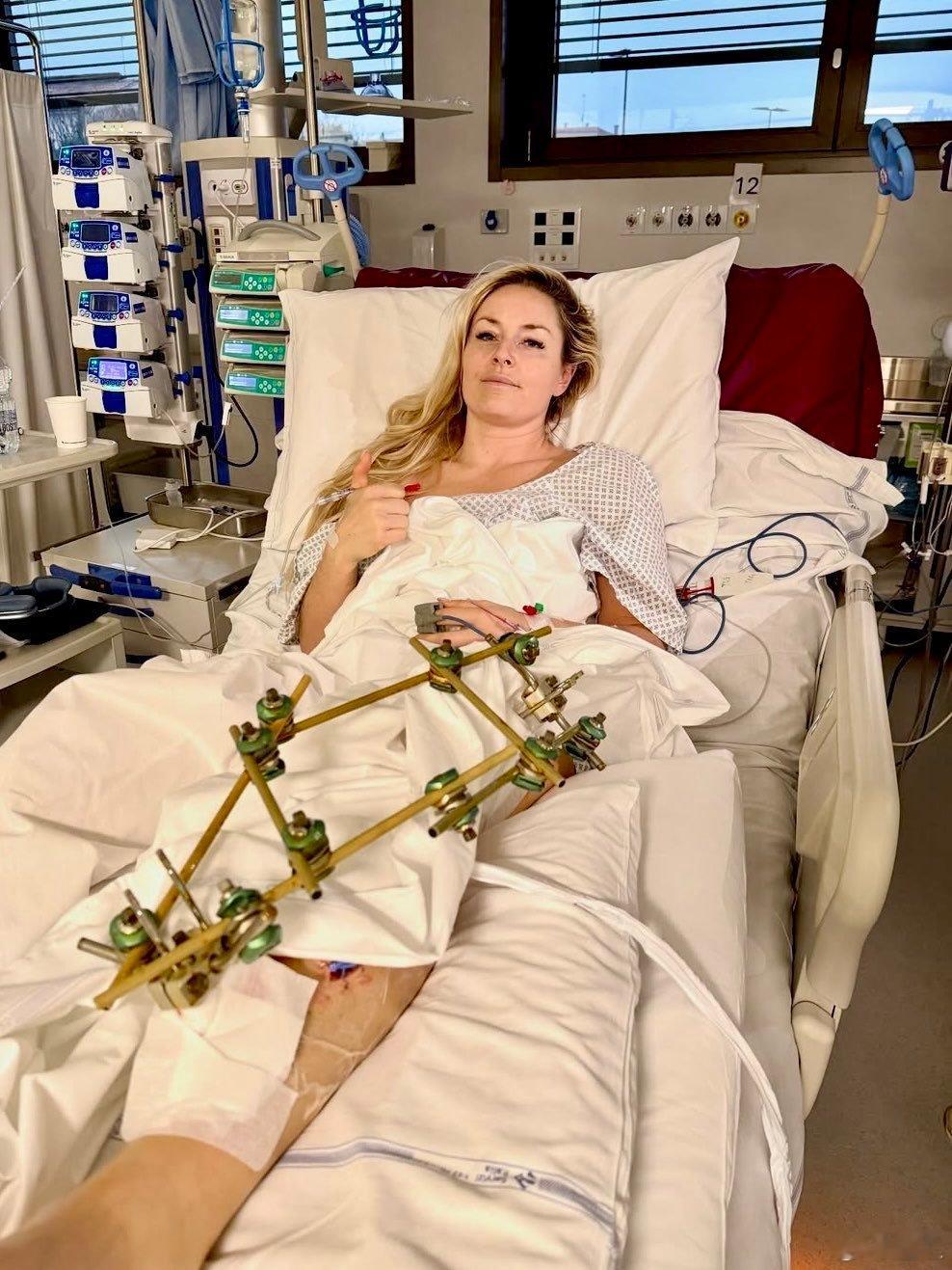 天，这是林赛沃恩这次冬奥会 受伤后骨折的治疗照片？吓人 