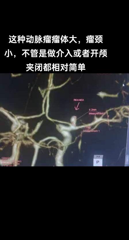 医学影像 科普一下 影像