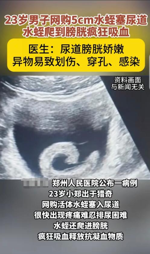 “好奇害死猫！”河南郑州，一23岁小伙听信某偏方，他出于好奇，竟然真网购一条5c