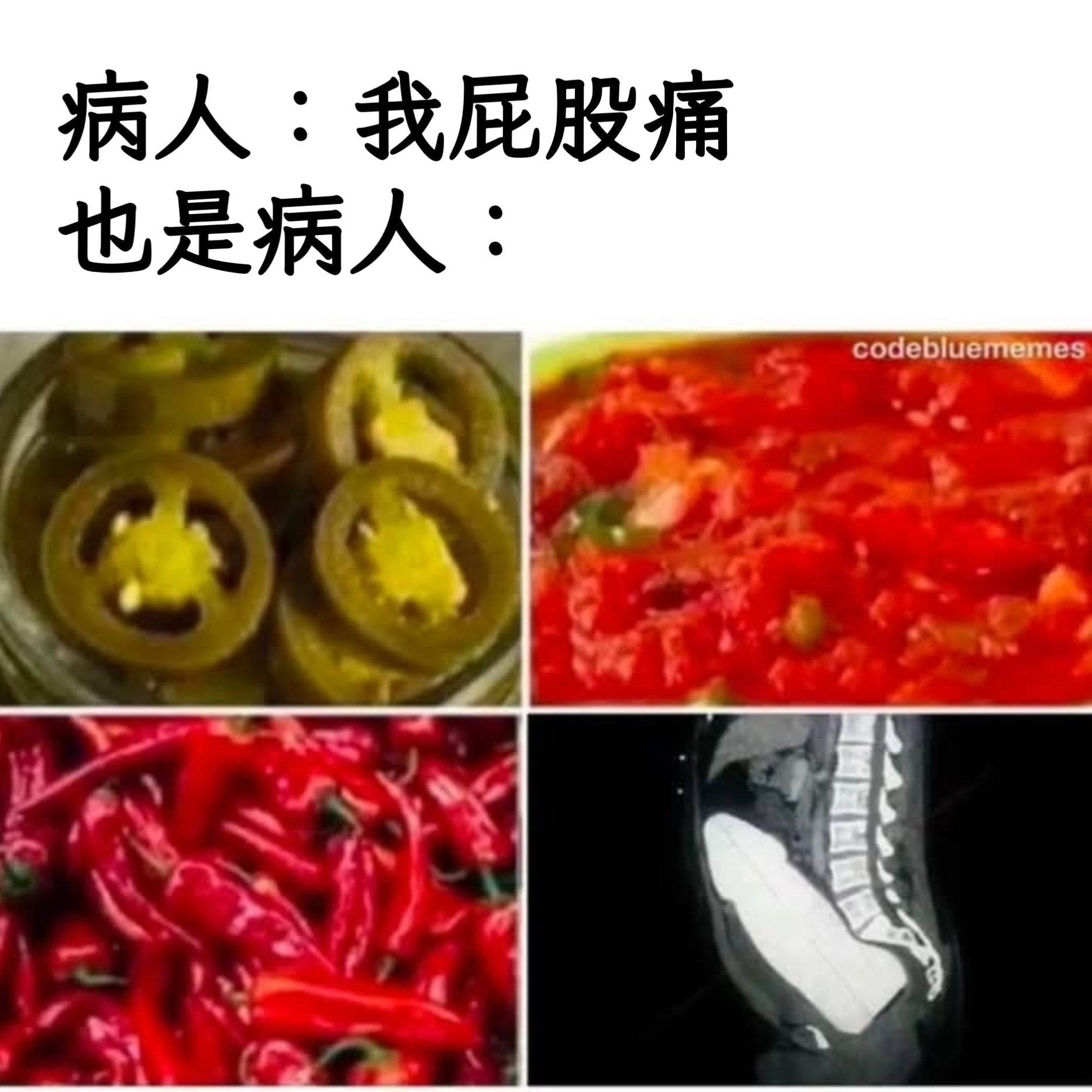 提高难度memes ​​​