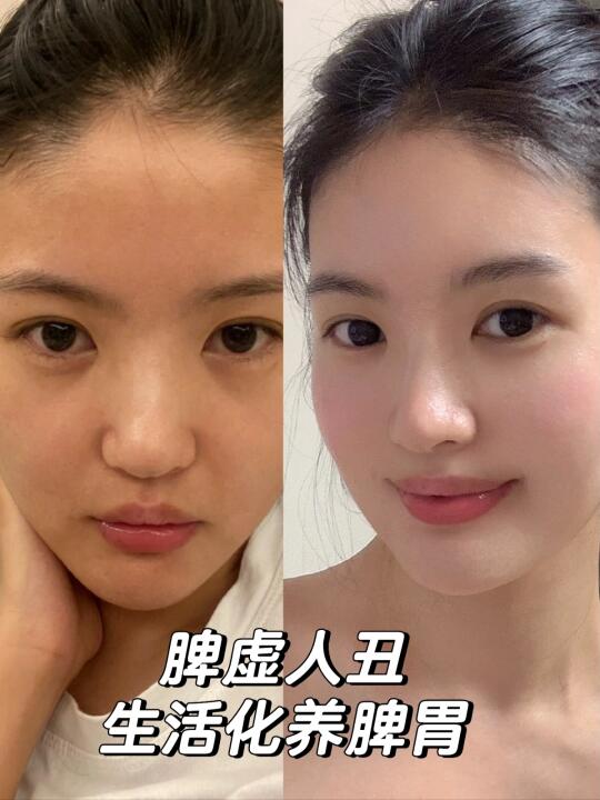 养脾胃篇｜我终于拥有了不垮脸的漂亮