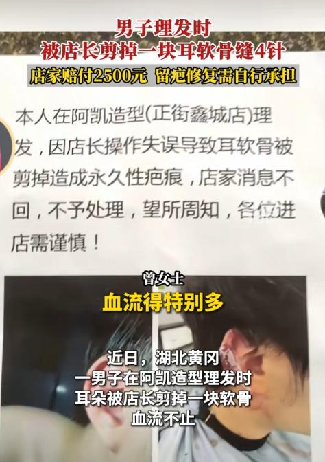 湖北黄冈，男子去剪头发，店长一个不小心，把他的一块耳软骨给剪了，他们拿创口贴止血