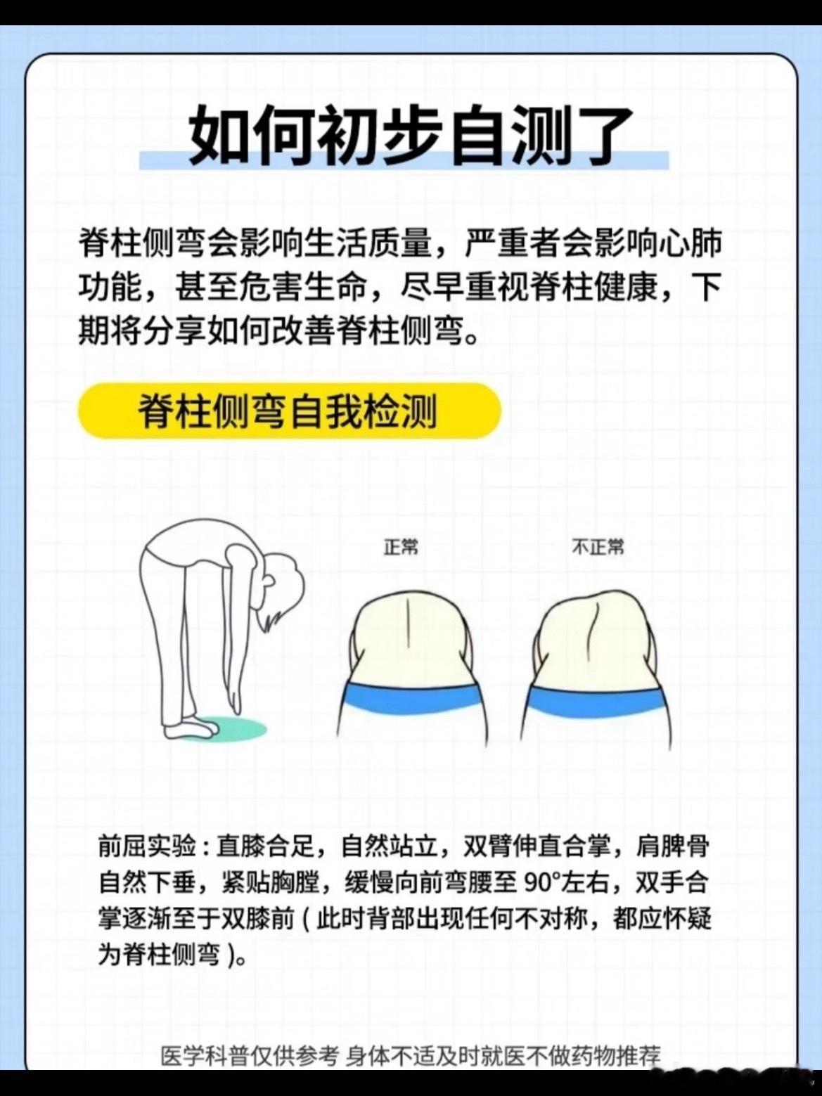 看演唱会发现自己脊柱侧弯了快快快，这个出问题挺吓人的，赶紧来自测一下吧