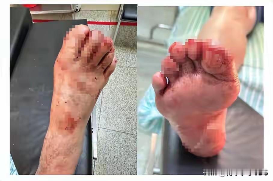 冬天洗澡别把命搭上！这颗“隐形炸弹”就在你家浴室，教你几招轻松拆除。
北风呼啸的