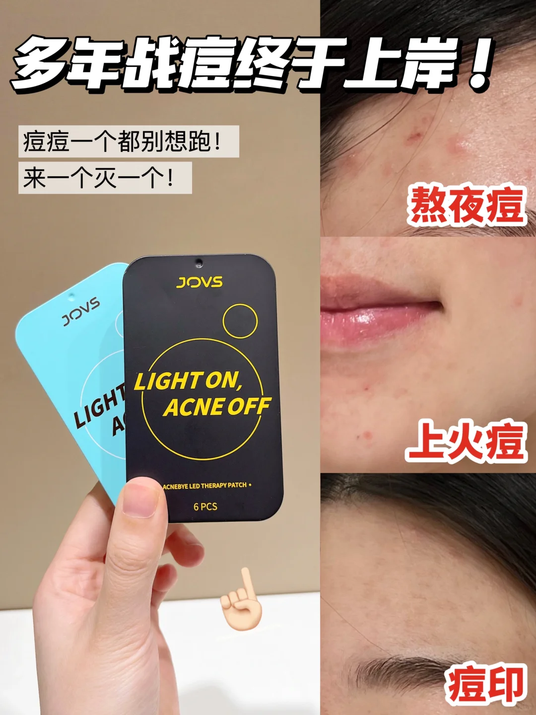有痘痘？对不起，不行！！
