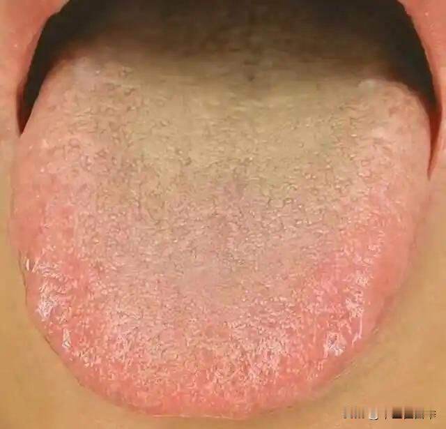 大便是健康的镜子，有这几种异常，可能是身体发出的“求救”信号
1. 大便干硬难排