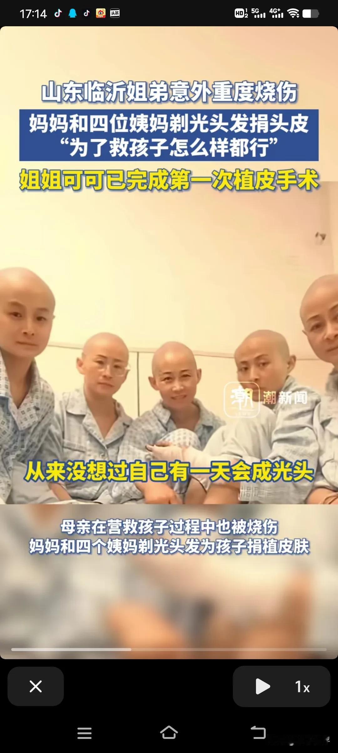 心疼+感动！妈妈和四位姨妈剃光头发捐头皮：“为了救孩子怎么样都行！”网友：这才是