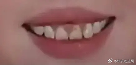 这么乱的牙，我才是白男的吧 