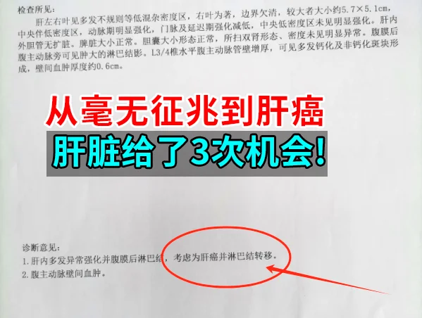 从毫无征兆到肝癌，肝脏给了3次机会！