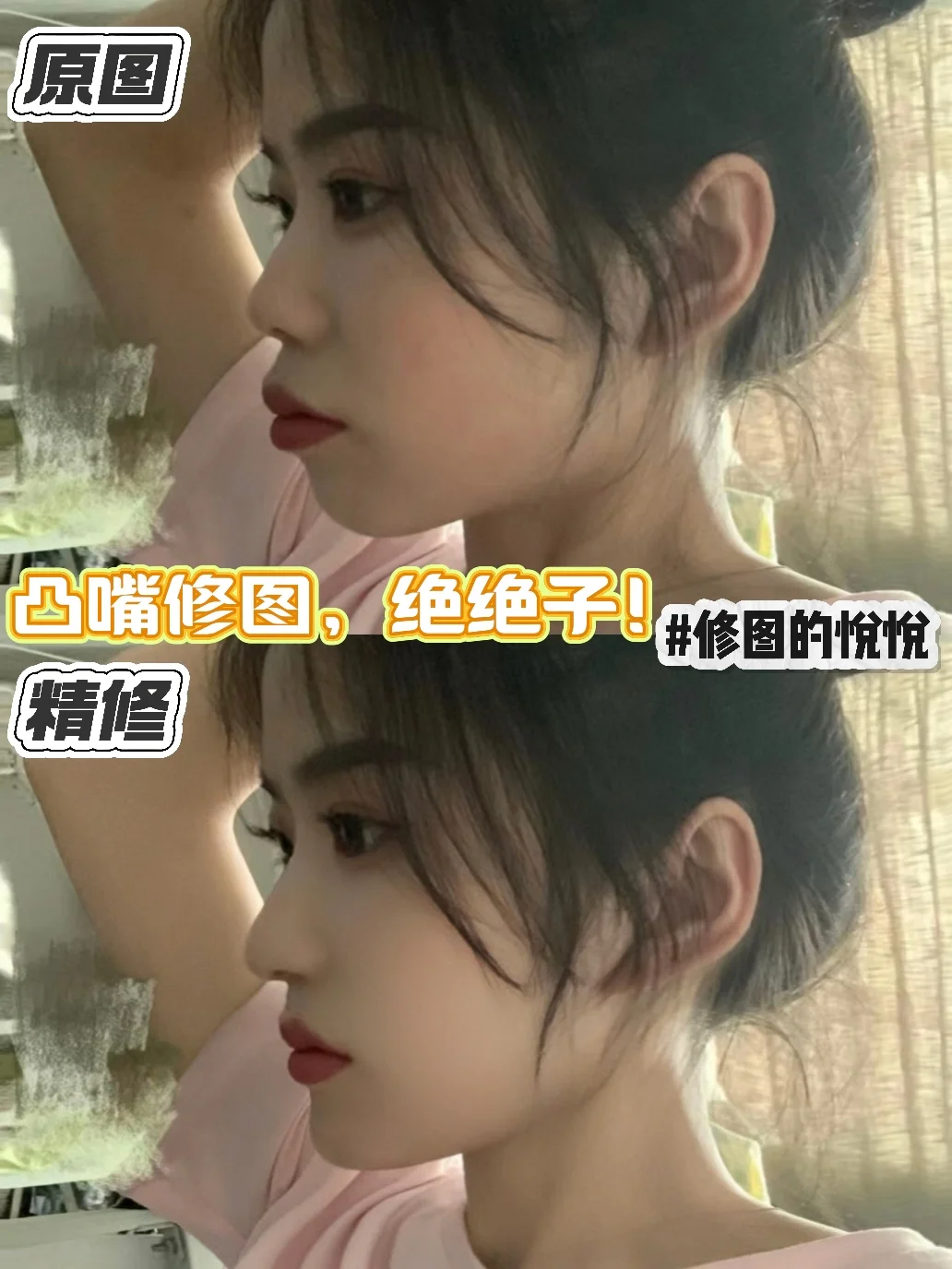 凸嘴也能美美的修出来，真的绝了❗️