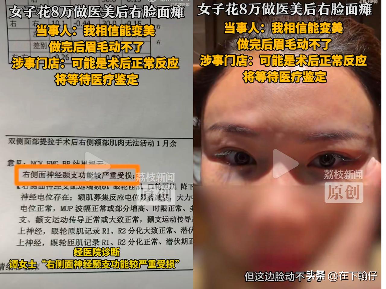 医美不是儿戏，安全永远要排在第一位。

上海谭女士的经历就是一个惨痛教训：今年1