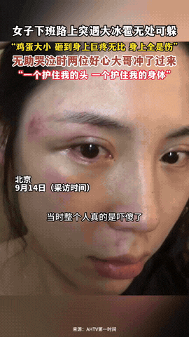 “这才是真爷们！”北京，一女子下班途中，突然下起了鸡蛋大的冰雹，因为没地方躲，女