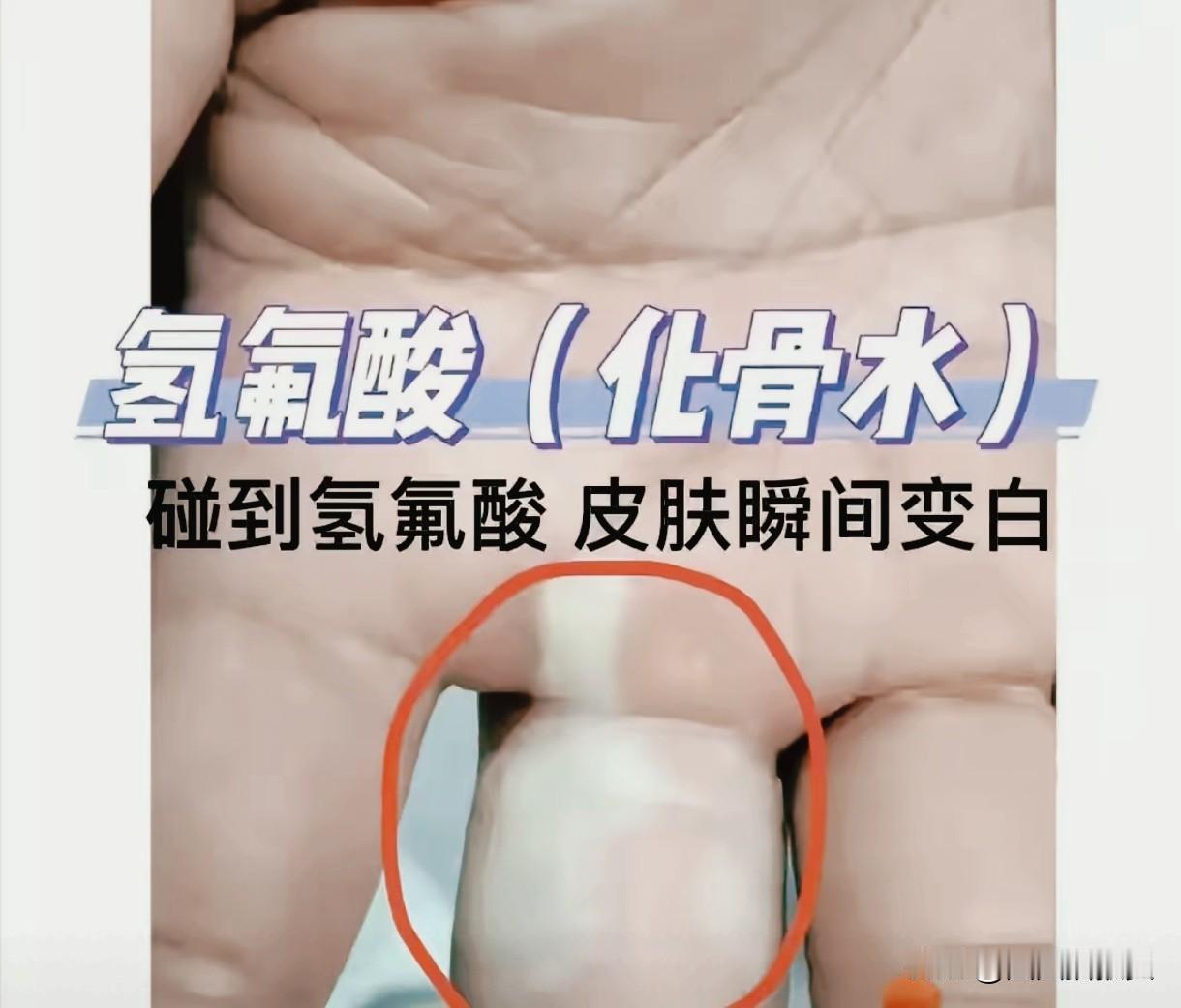 上午9点，杭州女子散步踩壶，液体溅伤脚，生活的意外究竟有多大？

杭州一女子，上