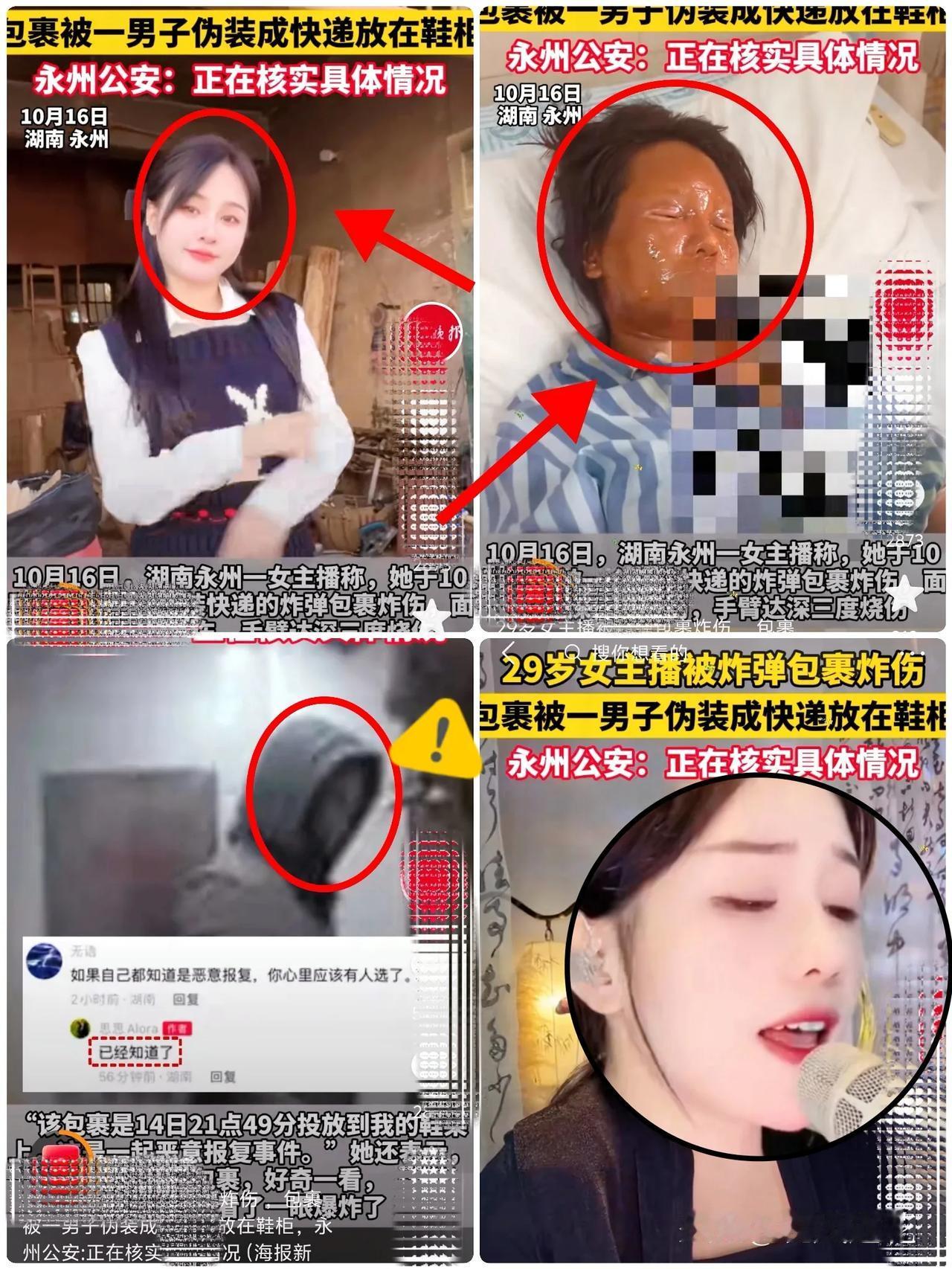 近日，湖南永州一名女主播，因好奇触碰门口“快递”，导致半张脸和胳膊严重烧伤毁容。
