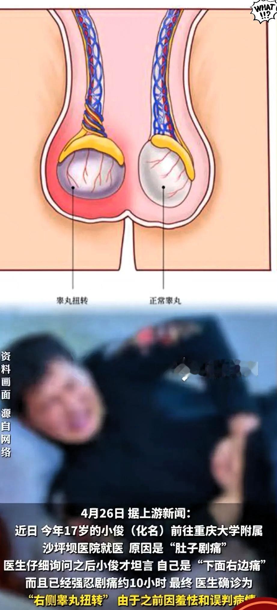 重庆17岁的小伙子，给所有的青春期的小青年上了一课！
不能因为那点传统观念，
就