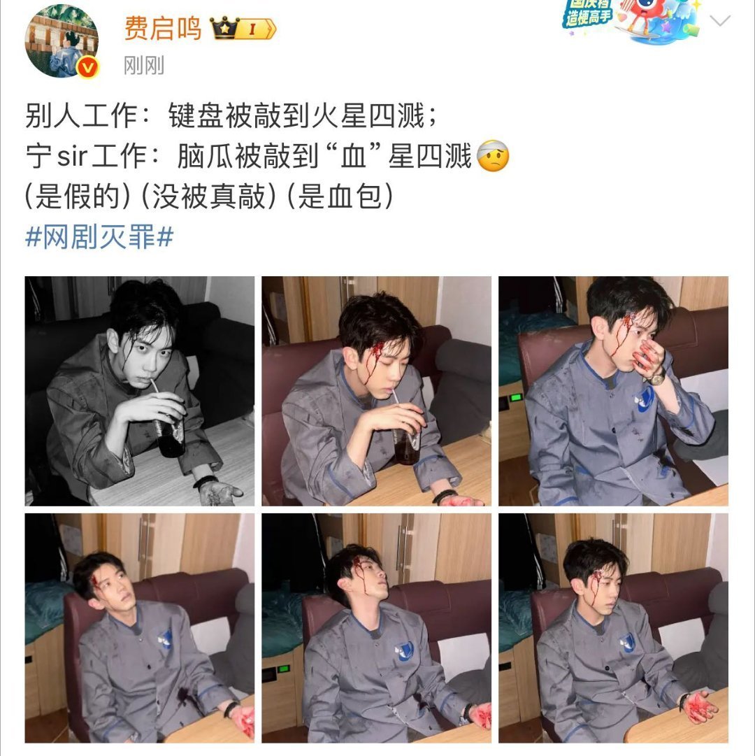 费启鸣新剧纯虐男主 启鸣在新剧中的表现简直是个突破！宁真从希望到绝望的转变，每一