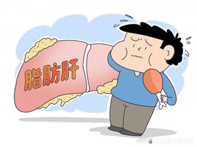 脂肪肝离肝癌有多远？有些人没肝硬化，却最容易被漏掉