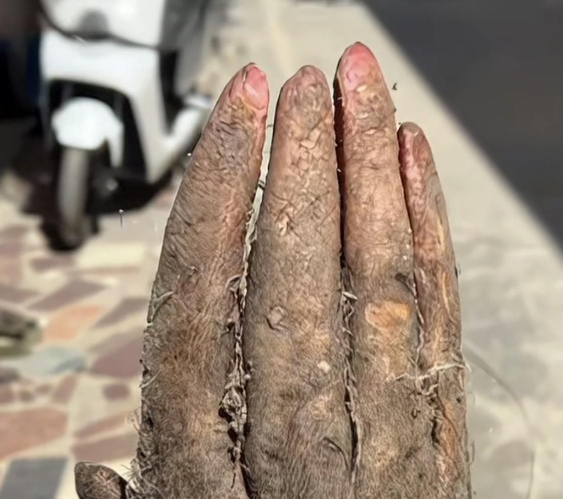 这山药长手套里了？
地里挖山药 ，
挖出一只人手， 一老人在自家菜地挖出形状酷似