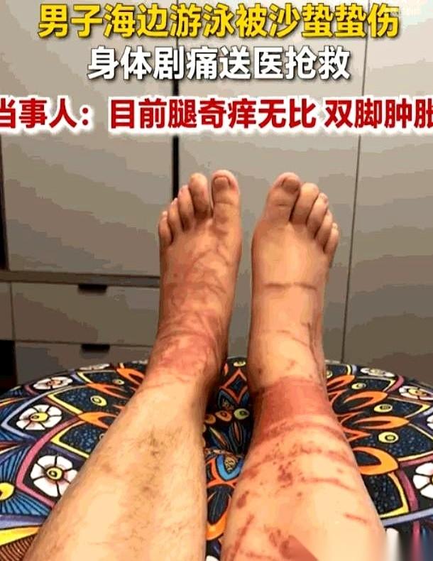 万万没想到，去海边玩，最要命的危险居然不在深水区。
一个哥们儿，在日照那种刚没过